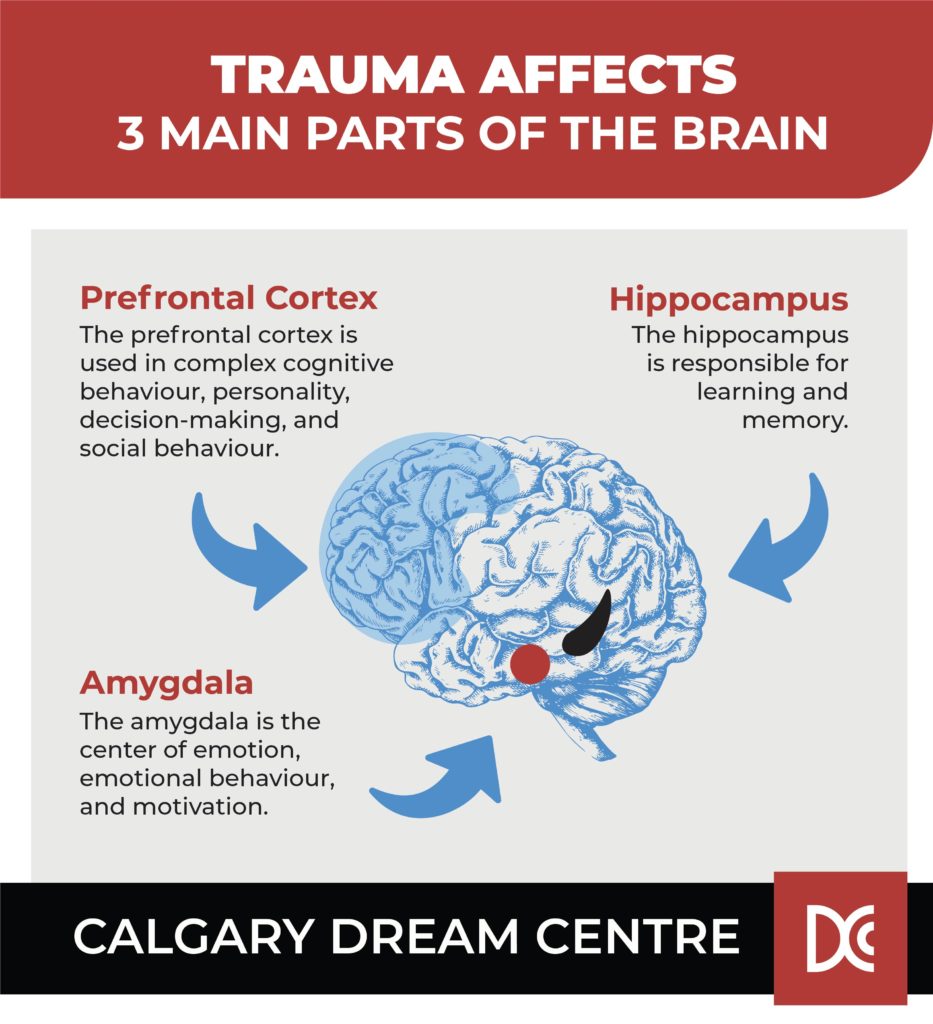 an infographic showing how trauma affects the three parts of the brain: prefrontal cortex, hippocampus and amygdala.